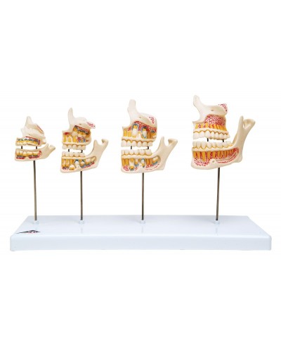 Ատամների զարգացման մոդել